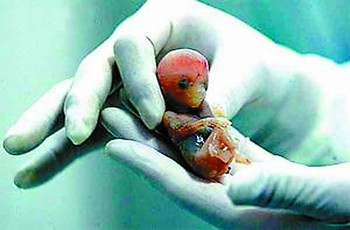 专家